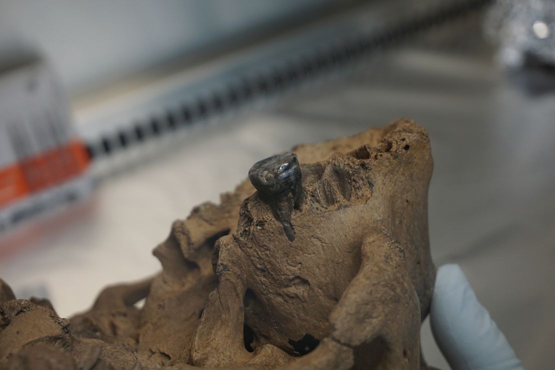 Scientists extracted DNA from dental calculus on the tooth.