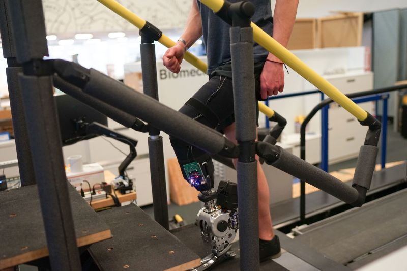 Bionic leg restores natural walking speeds and steps: ‘I didn’t feel like my leg had been amputated’