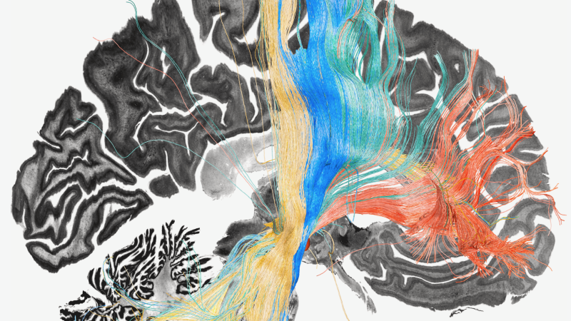 Hluboká mozková stimulace u mladého pacienta s OCD nefungovala, dokud nové mozkové mapy vše nezměnily