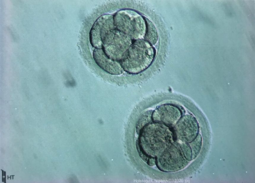 Embryos belonging to Christy Holstege are stored in an American Reproductive Centers clinic.