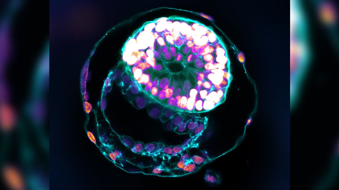 A stem-cell-based human embryo model, produced by Hanna and his colleagues, at the equivalent stage of development to day six in a natural human embryo.
