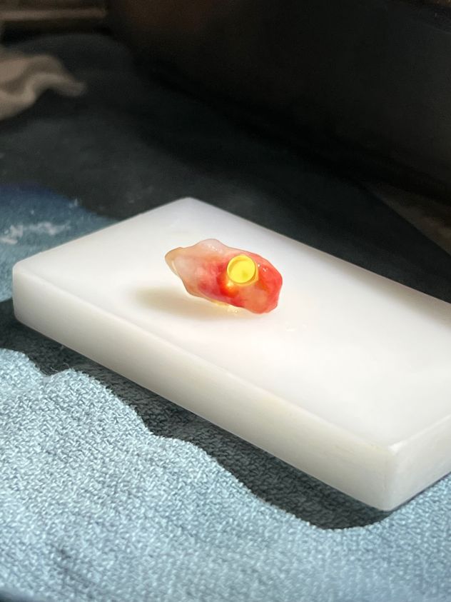 The shaved tooth, embedded with a plastic optical cylinder.