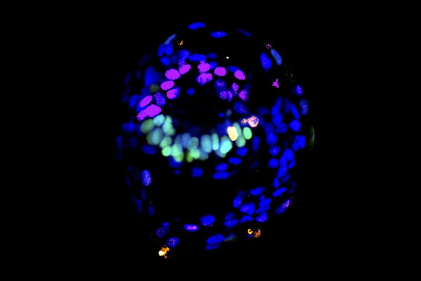 A human embryo-like structure generated from reprogrammed stem cells. The future body cells are colored green and the amnion, pink, form on opposite sides, separated by the amniotic cavity.