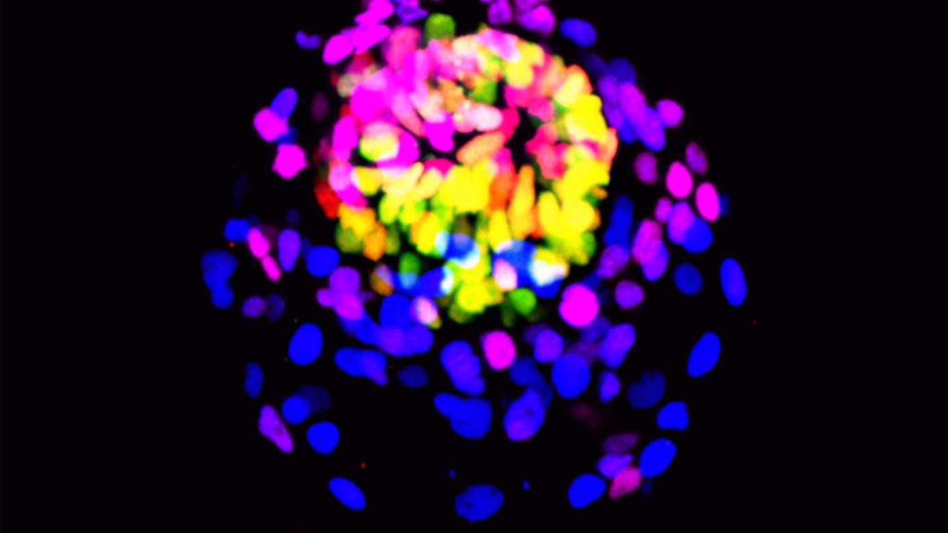 A human embryo model generated from reprogrammed stem cells by the lab of Magdalena Zernicka-Goetz, the Bren professor of biology and biological engineering at Caltech. The structure shows the different cell types present during the very earliest stages of human development.
