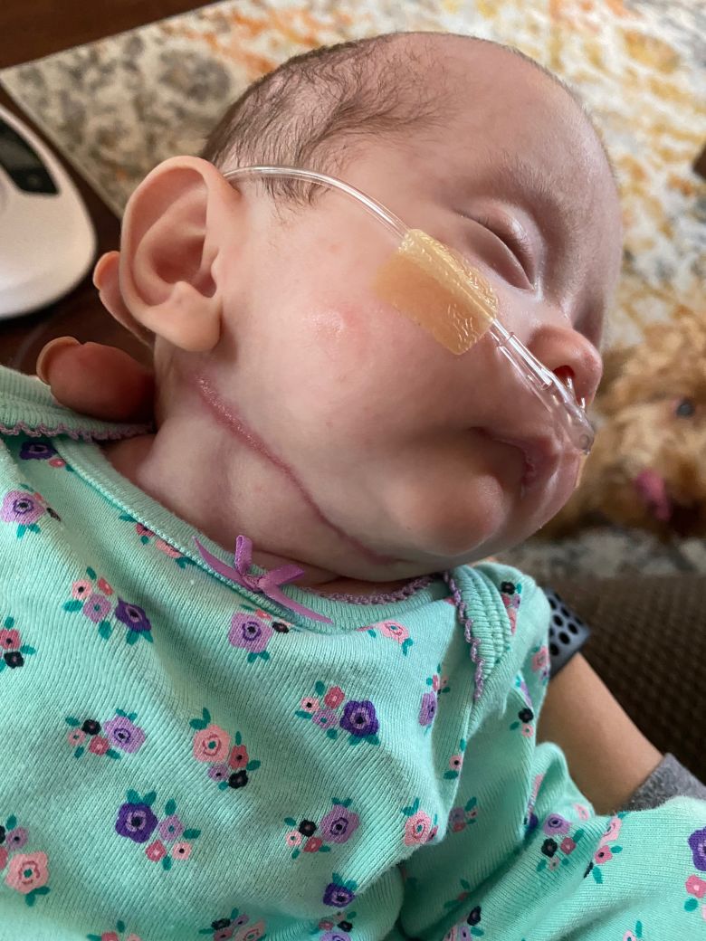 Eliana's wound healed in 10 days with minimal scarring, according to her care team.