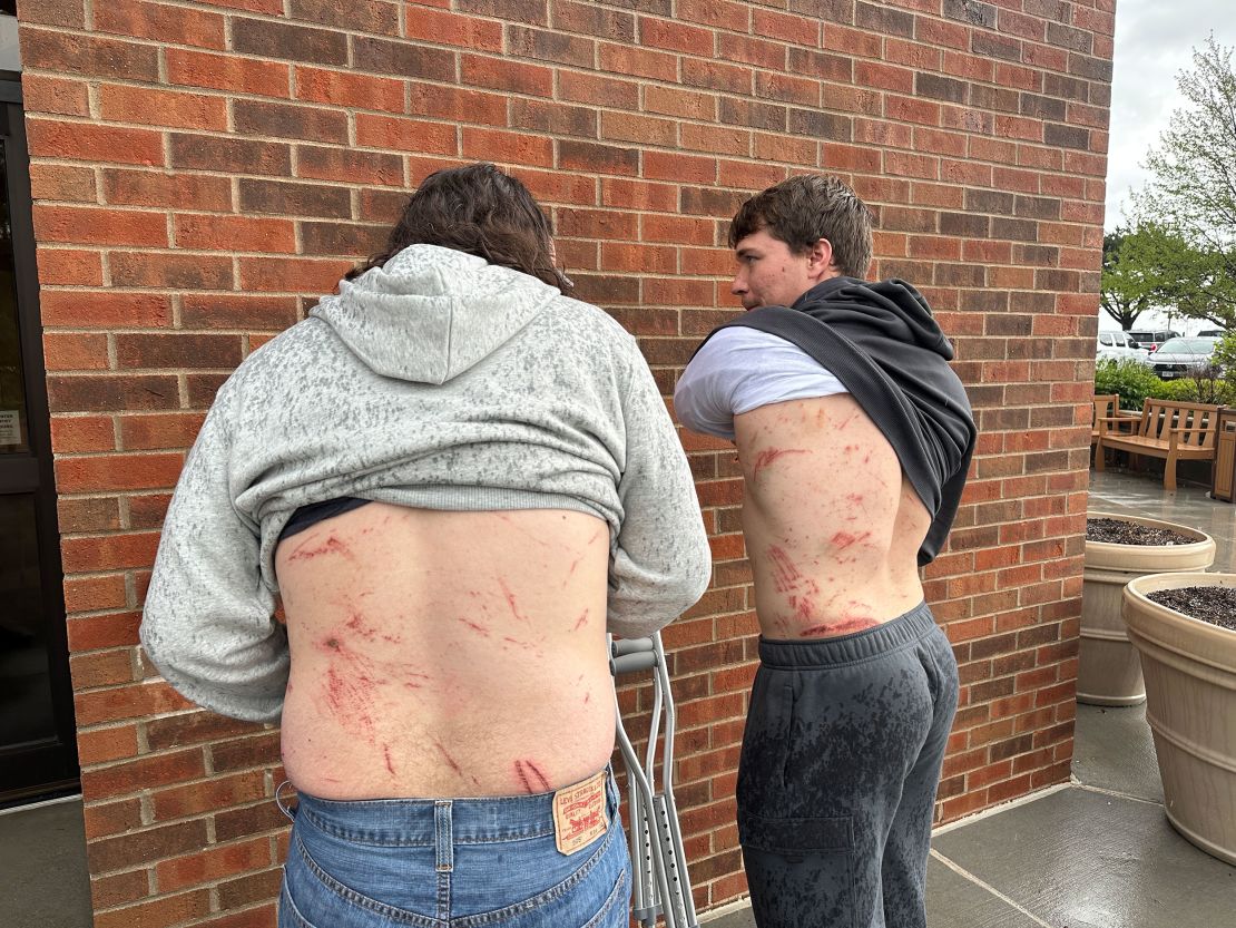 Roger Slatten, left, and his brother Royce, show their injuries from the storm.