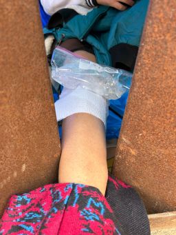 Aid worker Adriana Jasso said she had to treat a Colombian woman’s injured knee through the fence, since some migrants end up trapped between the primary and secondary border walls. Jasso said the woman told her she was four months pregnant.