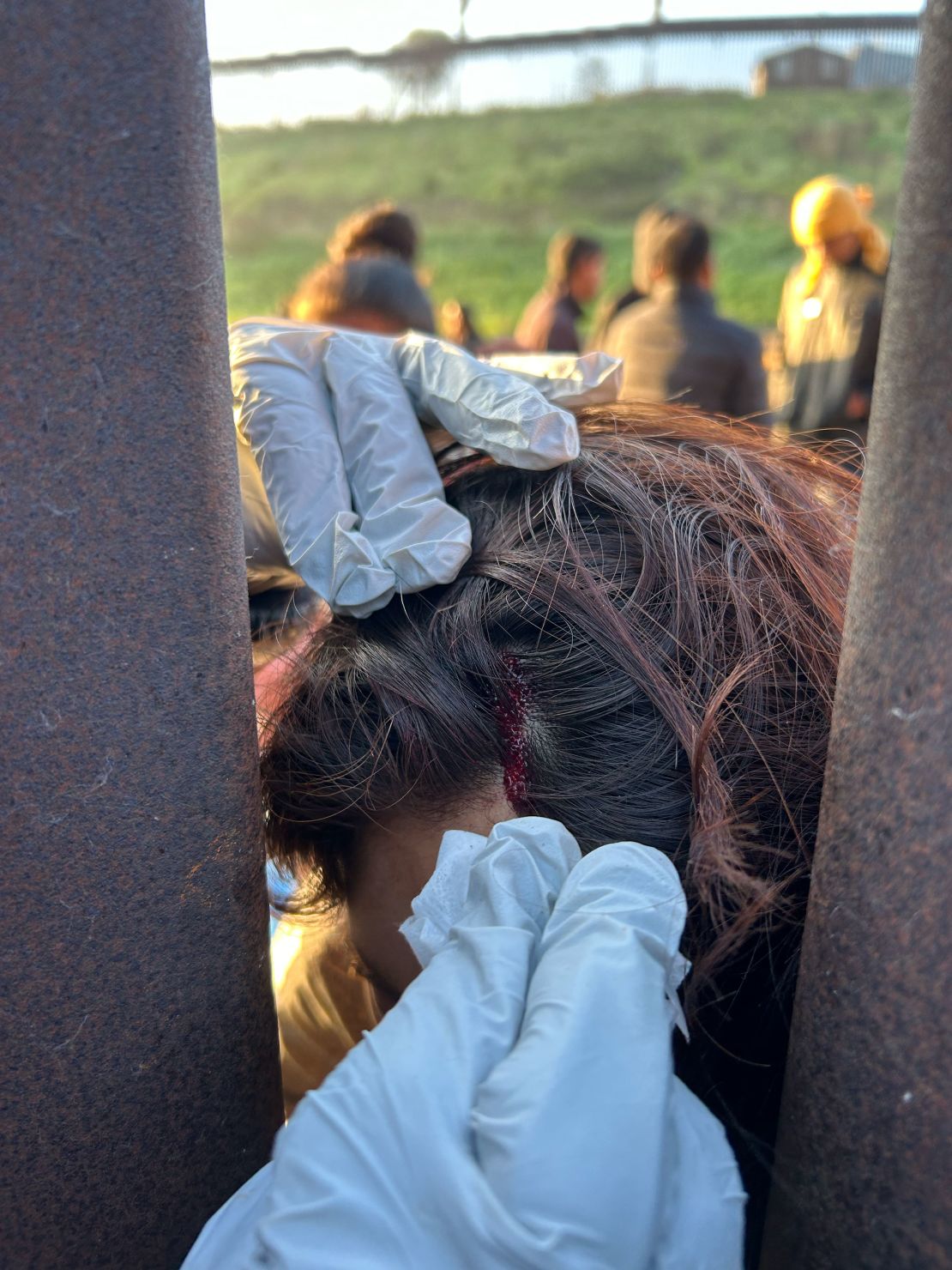 A humanitarian aid worker said she and other volunteers cleaned the wound a 15-year-old Guatemalan migrant sustained to her head when she fell as she crossed the border into California.