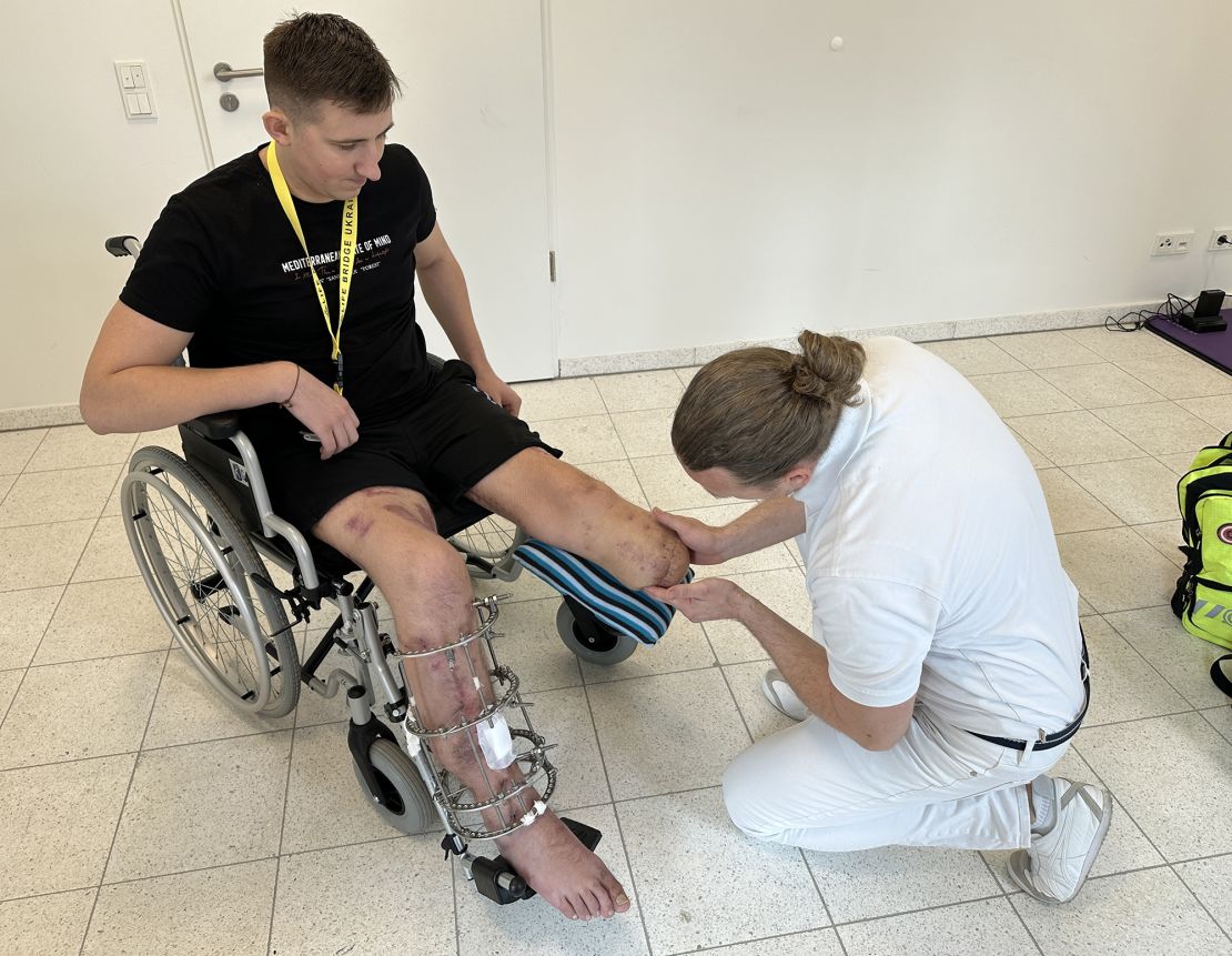 Orthopedic technician Marko Gänsl examines Valerii Omelchenko for a prosthetic fitting on his left leg. His right leg was kept in a metal frame while it healed.