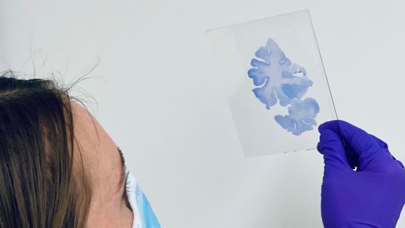 Вижте всички теми Връзка копирана Следвайте Човешкият мозък се свива