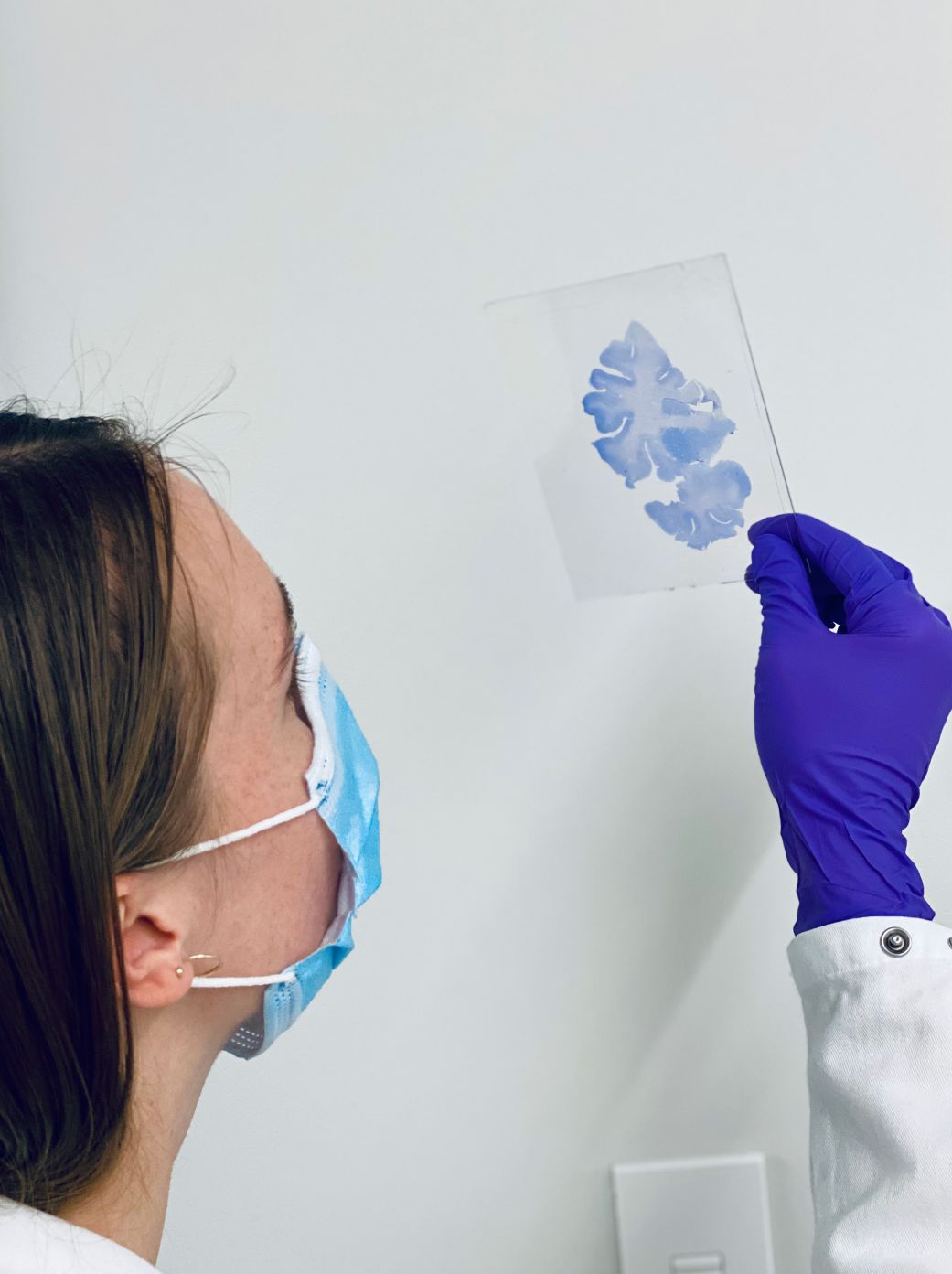 These entorhinal cortex neurons, shown enlarged in this image, are significantly larger in SuperAgers compared with same-aged peers and even younger individuals.