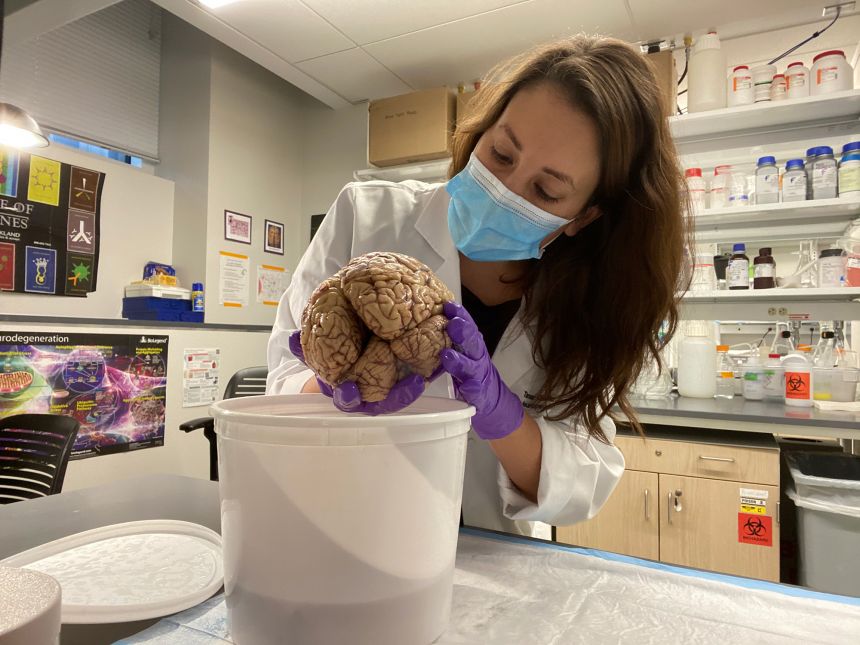 Tamar Gefen holds a younger brain that is used for comparison with brain tissue of SuperAgers.
