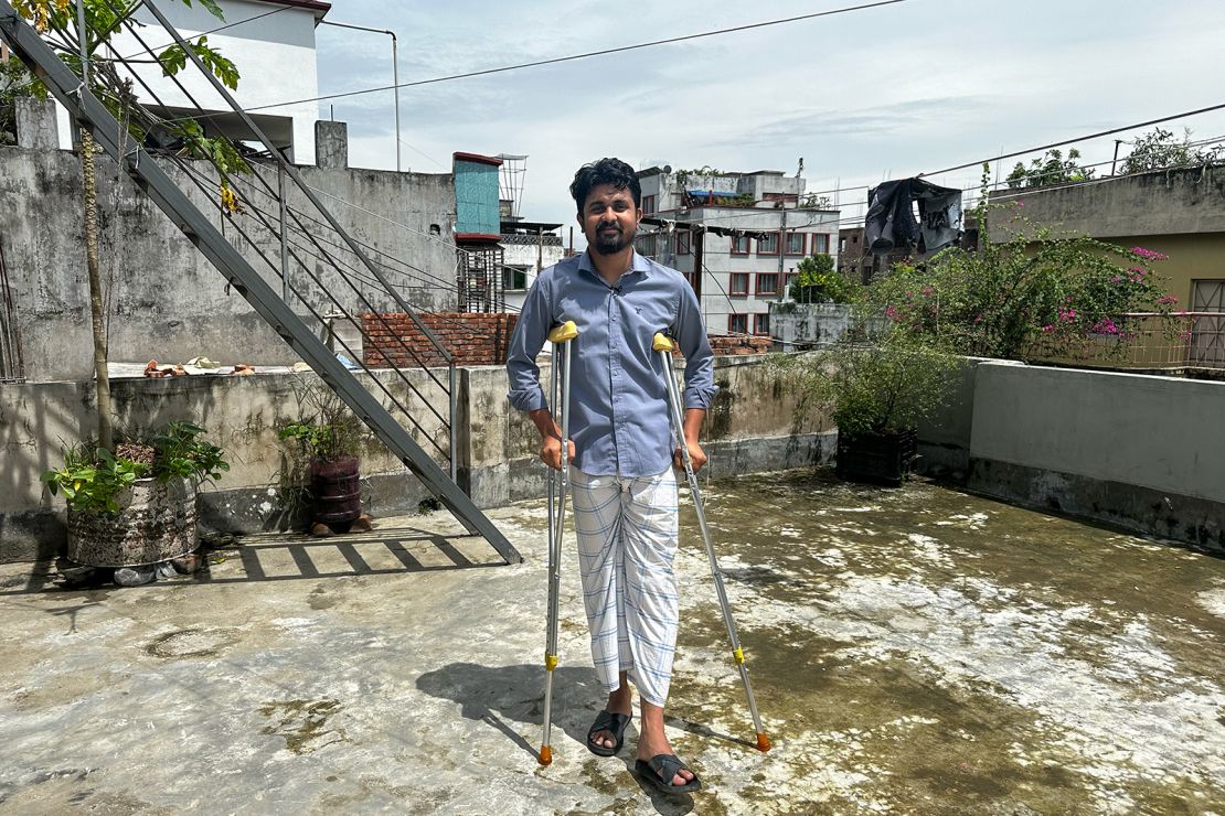 Iftekar Alum still finds it difficult to walk on his broken foot.