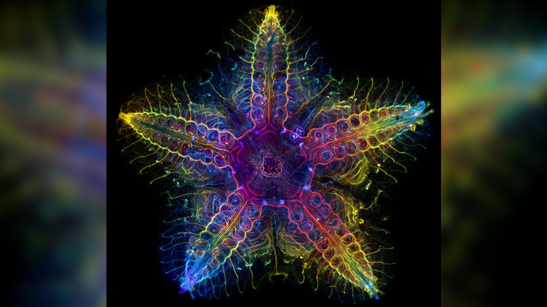 The nervous system of a starfish is shown here during an analysis.