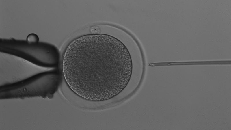 https://media.cnn.com/api/v1/images/stellar/prod/kangaroo-egg-about-to-be-injected-with-a-single-sperm-cell.jpg?c=16x9&q=w_800,c_fill