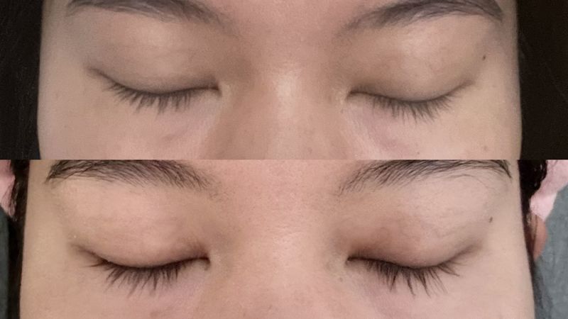 Latisse 2024 eyelash serum