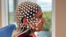 Researcher Kristian Jensen wearing the high-density headset for LDAEP. The headset comprises 256 electrodes, plus earphones; these can give sound tones ranging from around 60dB (which is as loud as a conversation) to 100dB (as loud as a loud hairdryer).