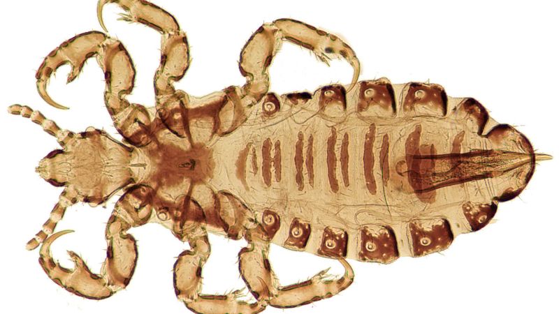 How head lice reveal secrets about human origins