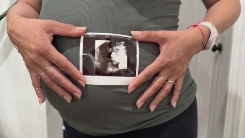 Meny sostiene una ecografía de su hijo. Nota del editor: CNN ha editado partes de esta foto para proteger la privacidad de Meny.