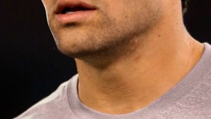 https://media.cnn.com/api/v1/images/stellar/prod/marksanchezstabbed-thumb.jpg?c=16x9&q=w_800,c_fill