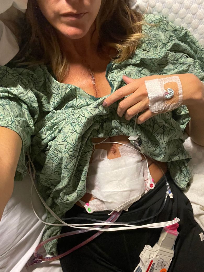 Summer McKesson post surgery scar