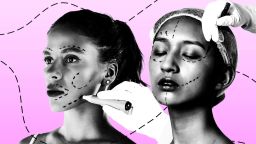 Meet the 30-somethings having facelifts V2.jpg