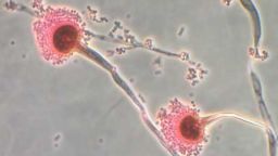 El Aspergillus, un tipo de hongo, está expandiendo su área de distribución con el aumento de la temperatura global, según una nueva investigación.