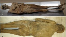 External appearance of the mummy from the ventral (A) and dorsal side (B) showing a completely intact body wall .