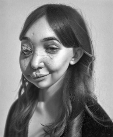 Emmy-award-winning TV presenter<strong> </strong>Nikki Lilly has an arteriovenous malformation, where missing pathways between veins and arteries cause the veins to expand and rupture. She said in a press release that: “Kelvin's dedication to capturing the truest versions of us within his portraits has reignited something within me — a sense of courage and even a childlike wonder I thought I’d lost.”