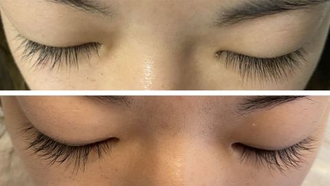 No makeup: Before using Grandelash-MD Lash Enhancing Serum (top) and after (bottom).