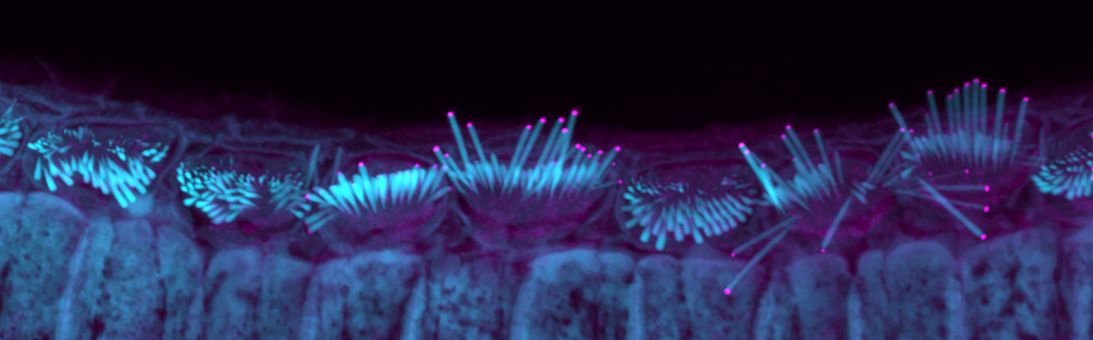 “I fell in love with the hair cell, these mysterious cells in our ear, because the system was so amazing, how it all comes together and how it all works,” Manor said. Pictured here: a microscope image of mouse hair cells from Manor's lab. The pink tips show the result of gene therapy helping the hairs grow.