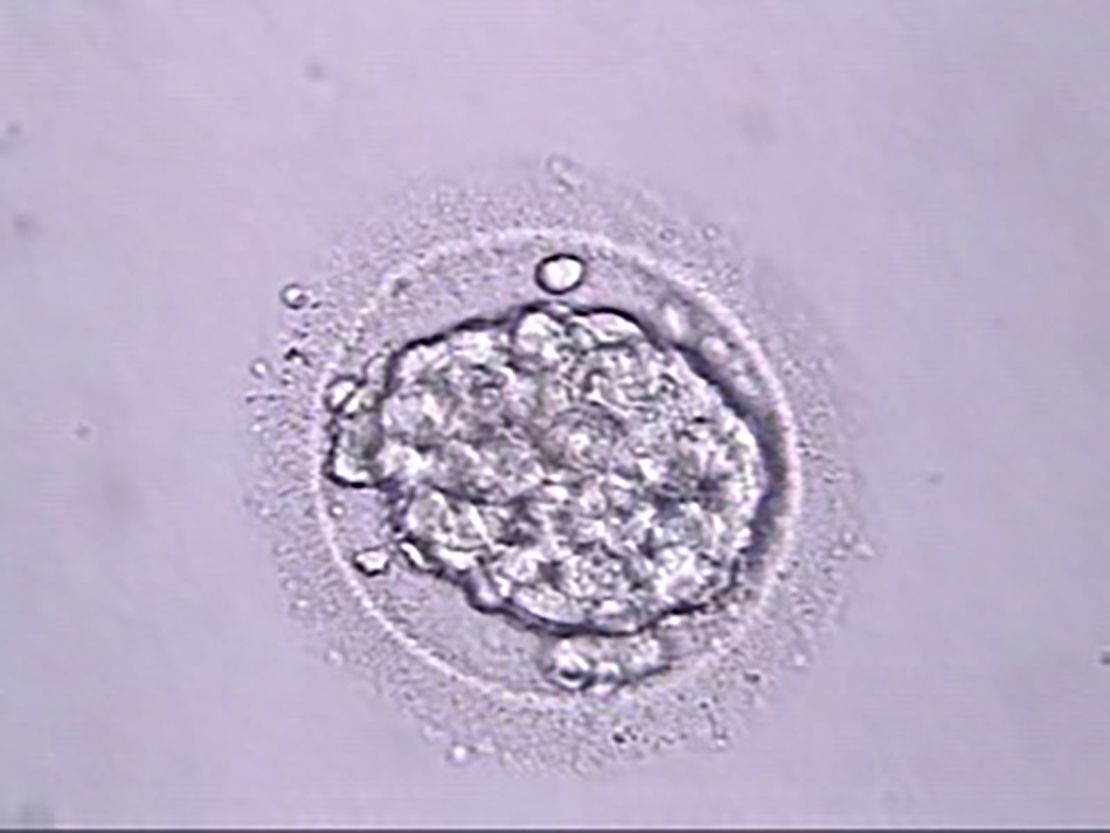 One of the embryos transferred.