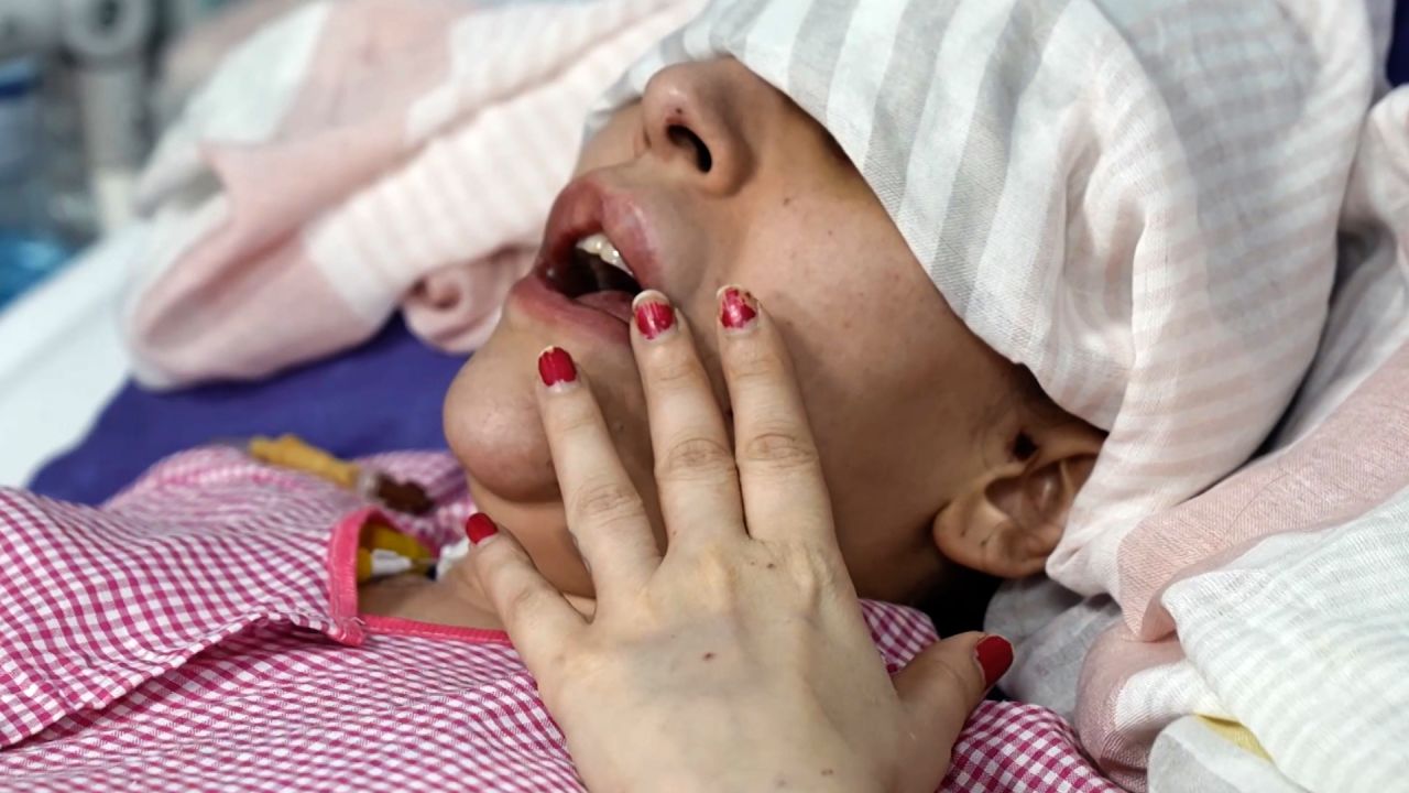 CNN muhabiri Fred Pleitgen, hava saldırılarında yaralanan vatandaşların görüşlerini dinlemek için İran'ın başkenti Tahran'daki bir hastaneyi ziyaret etti.