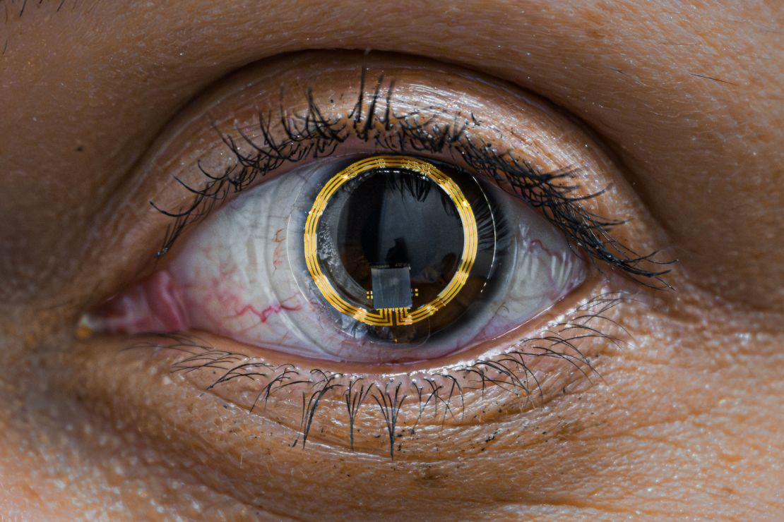 Mission Specialist Sarah Gillis, SpaceX's Chief Operations Engineer, wears a data collection contact lens before the SpaceX Polaris Dawn mission.