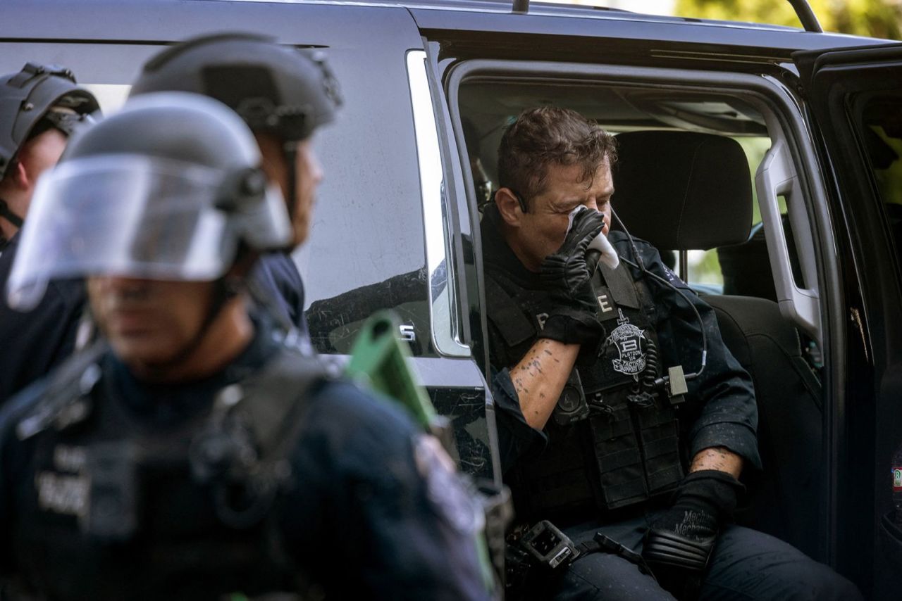 Un oficial de la División Metropolitana del Departamento de Policía de Los Ángeles trata una lesión en su rostro.