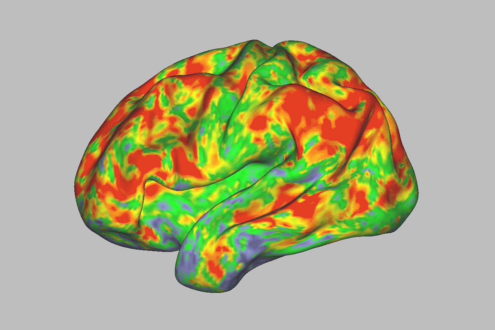 This is a healthy brain on psilocybin | CNN