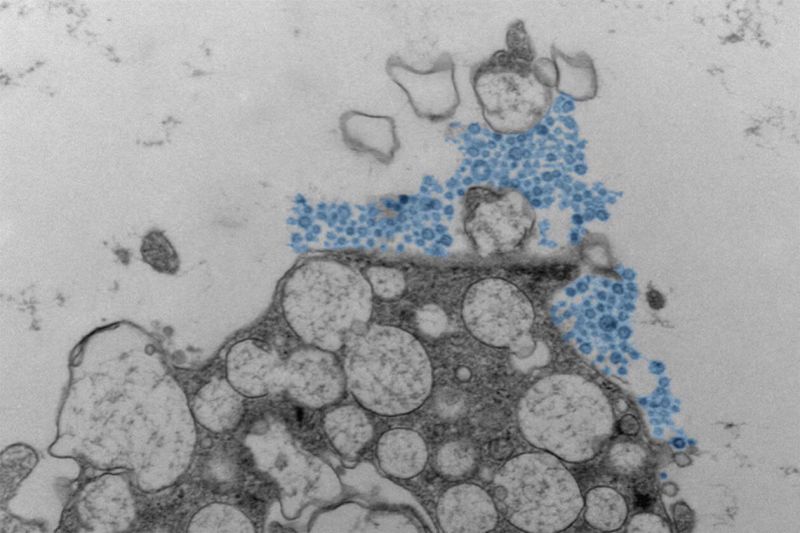 Koenimbine Alleviates Cerebral Ischemia-Reperfusion Injury in Rats