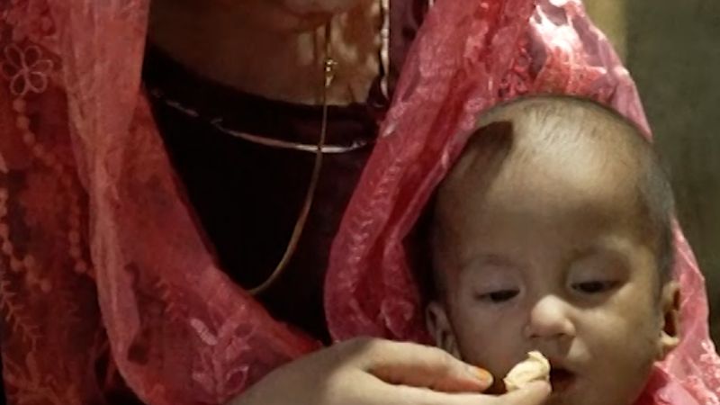 In the world’s largest refugee camp, Rohingya children are going hungry after USAID cuts