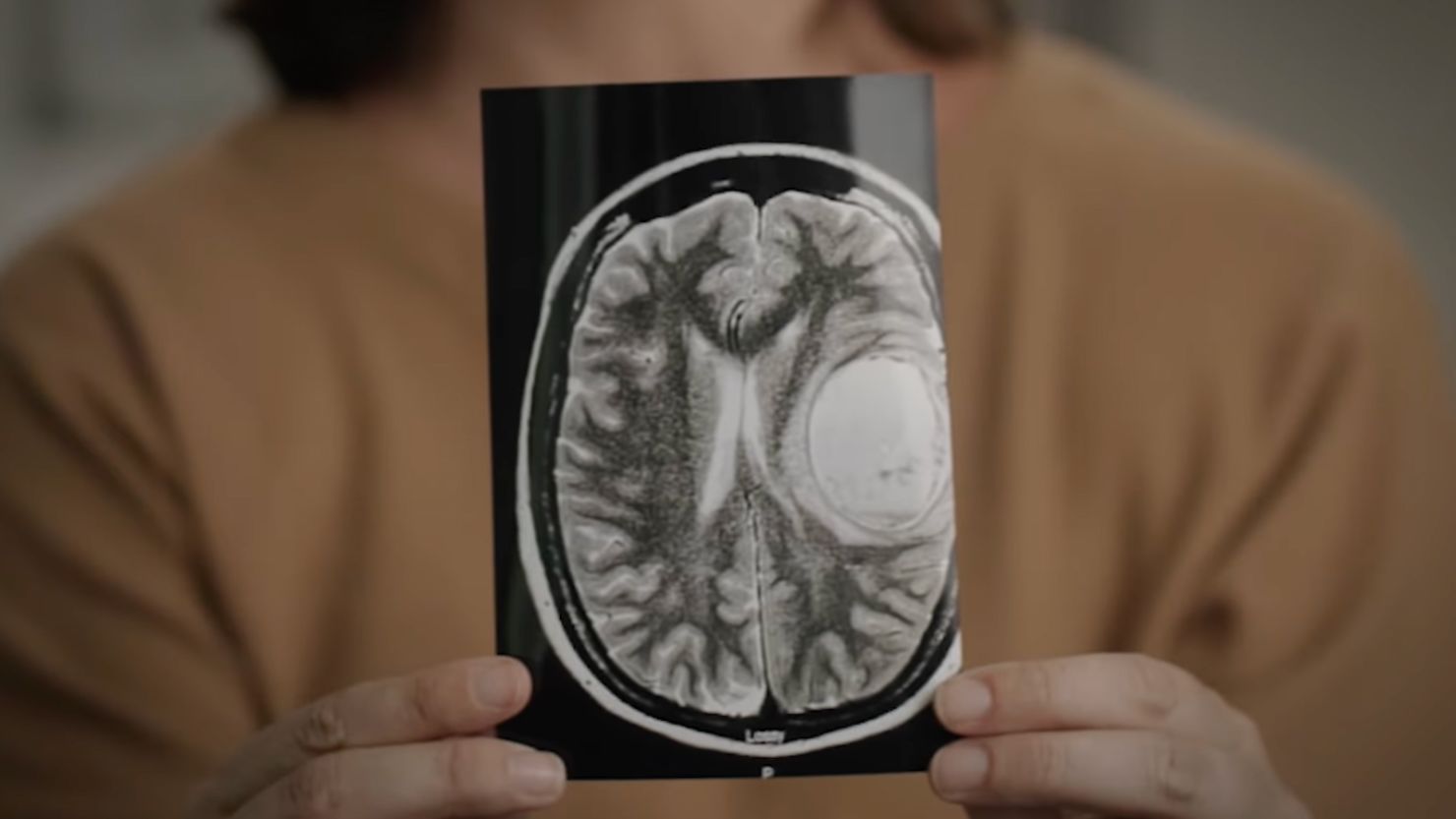 The "Yes on 4" campaign advertisement features a woman diagnosed with brain cancer during her second pregnancy.