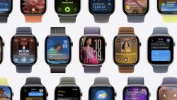 Apple Watch Series 11