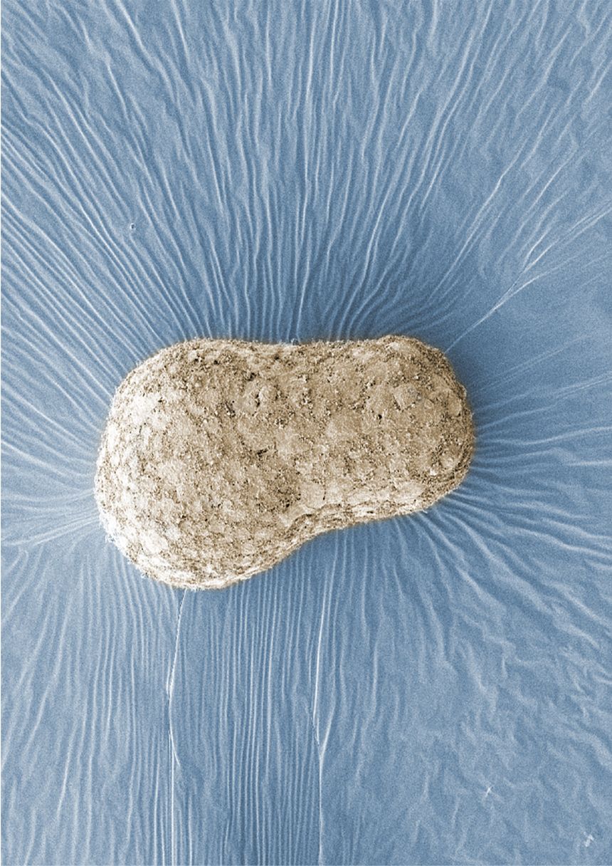 An image of a human embryo model developed by researcher Naomi Moris at The Francis Crick Institute in London that was taken with a technique called scanning electron microscopy, which shows the cluster of cells in three dimensions.