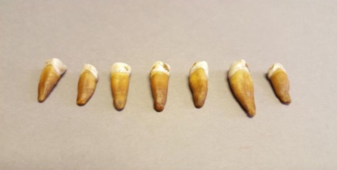 Seven of Well-man's teeth have been found.