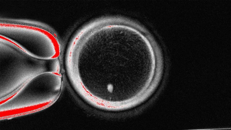 Scientists use human skin cells to create functional eggs, opening a door to new infertility treatments
