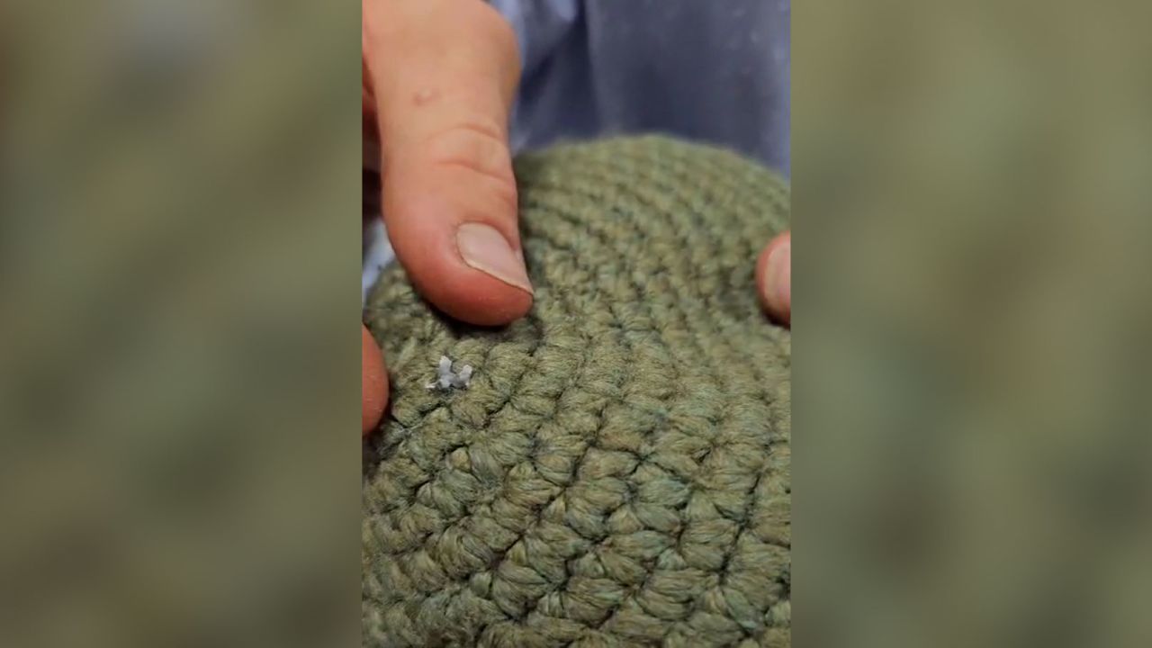 A still from a video released by Laniado Hospital shows a piece of shrapnel lodged in the kippah.