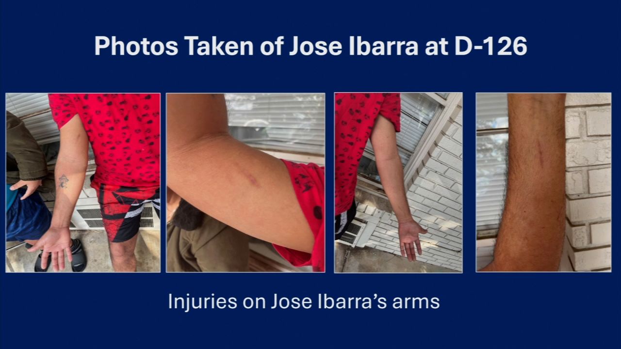 Photos of Jose Ibarra's injuries are presented to the jury on Wednesday.