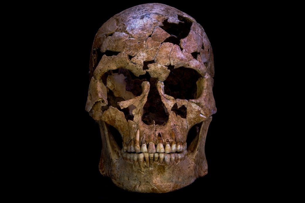 The skull of the man found at Vietnam's Thung Binh 1 cave was shattered and flattened. This image shows the skull after reconstruction.