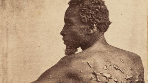 
The Scourged Back

c. 1863
