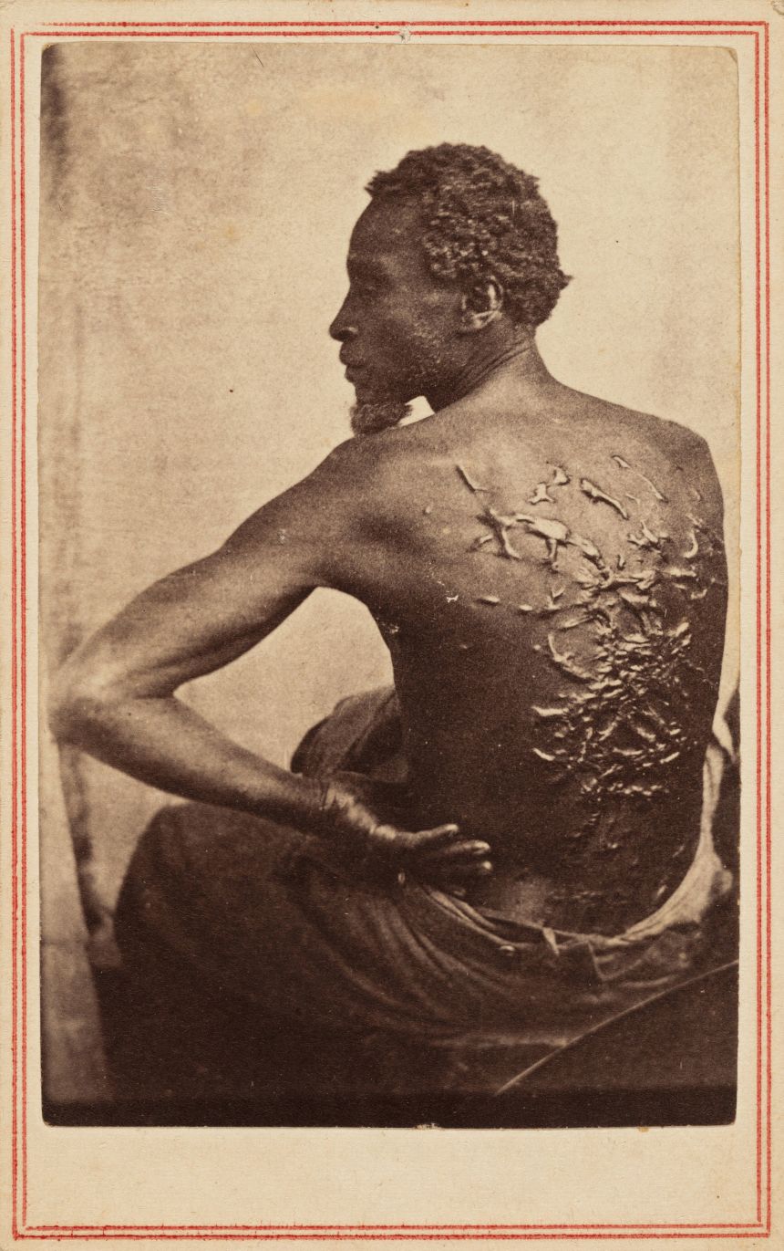 Shot in 1863, "Scourged Back" was a key image in abolitionists' anti-slavery campaigns during the American Civil War.
