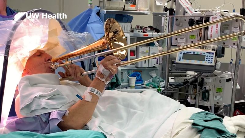 Video: Man plays trombone during brain surgery