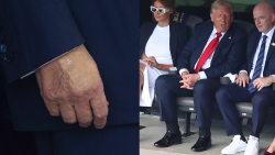 trump hand ankles july split .png